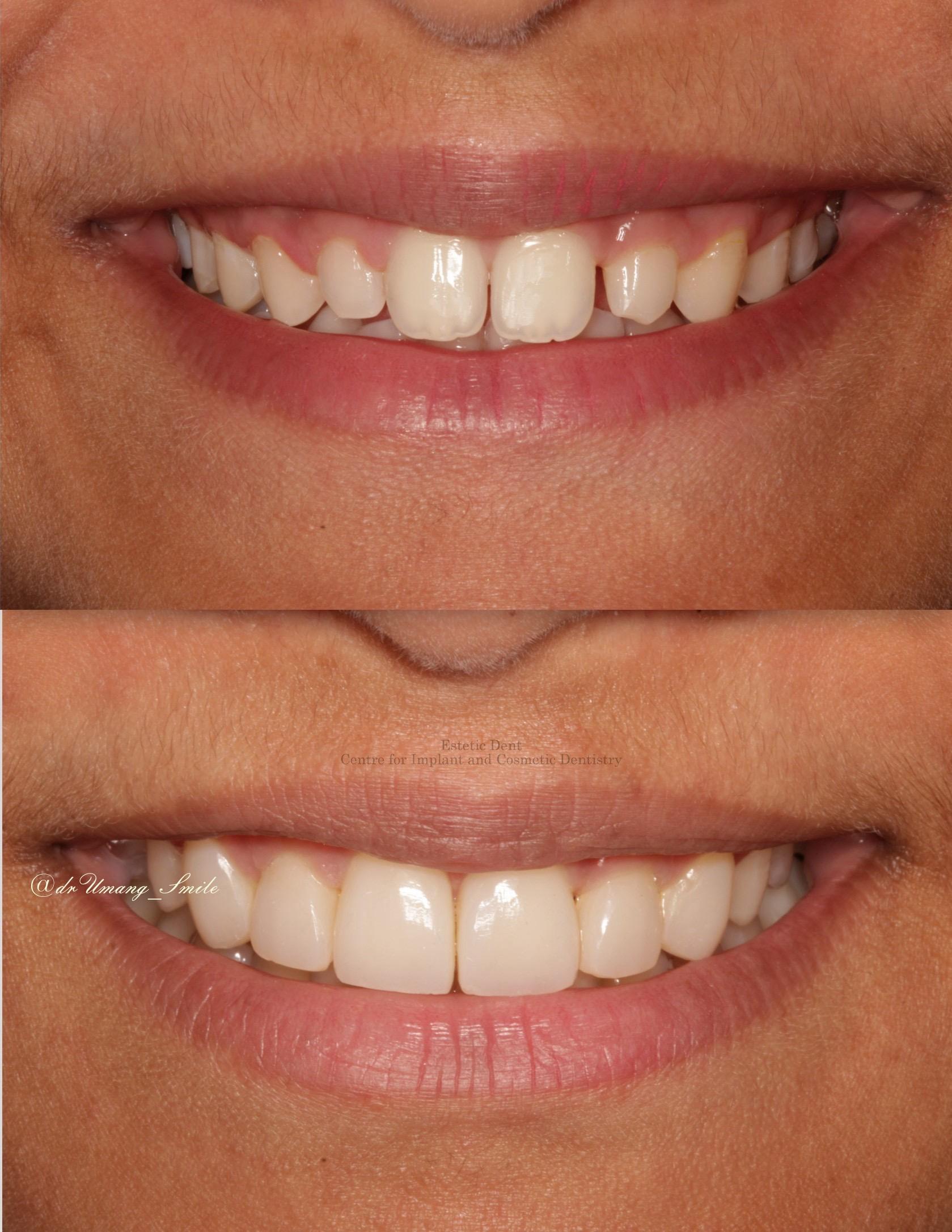 Best Dentist In NIBM