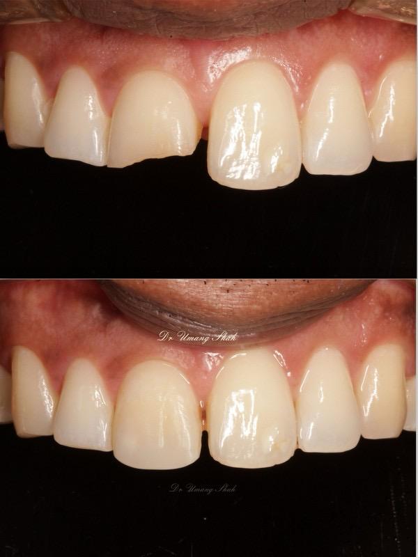 Child & Pediatric Dental Care