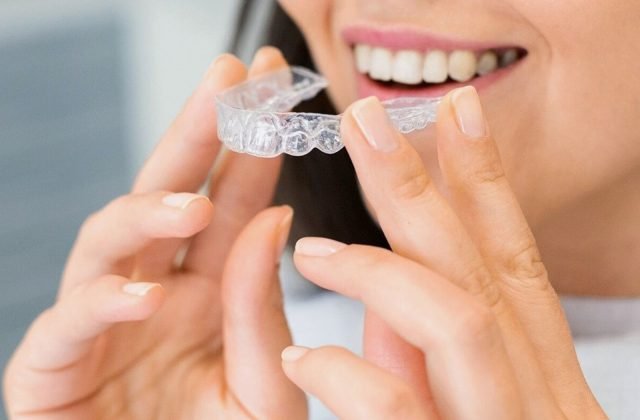 Woman placing a clear Invisalign-style aligner — orthodontics at The Dental Ethics, Pune